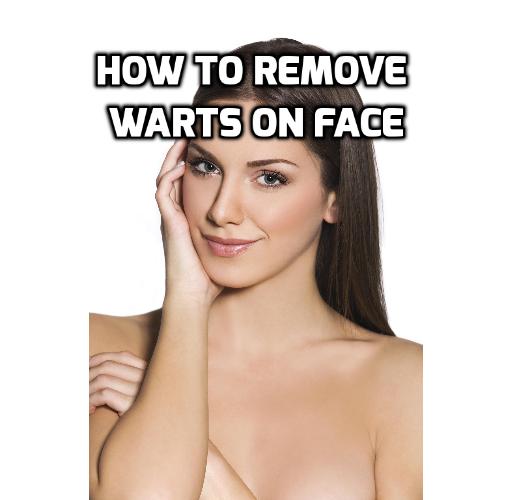 best way to get rid of warts on face