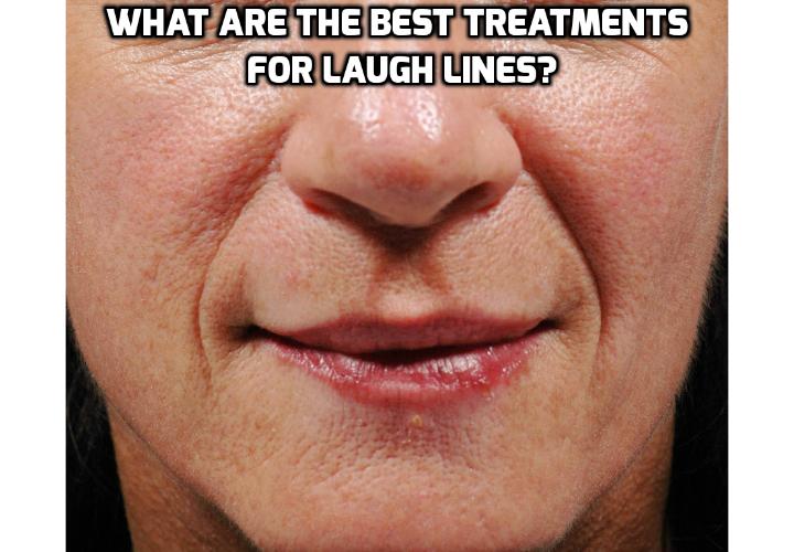 what-are-the-best-treatments-for-laugh-lines-anti-aging-beauty